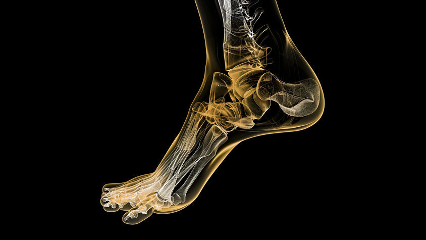 Rappresentazione della compressione del nervo del piede.